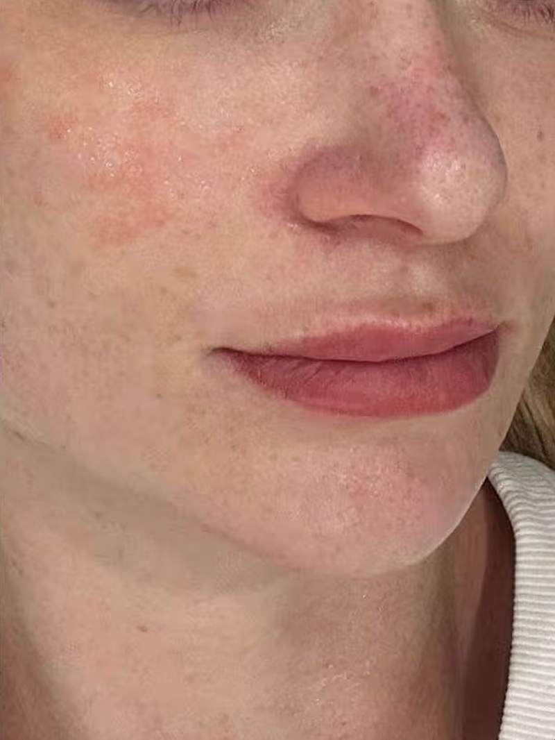 Monat 2