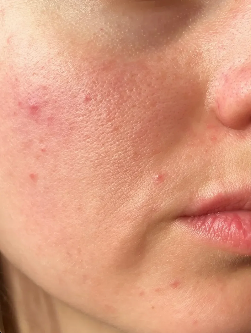 Monat 0
