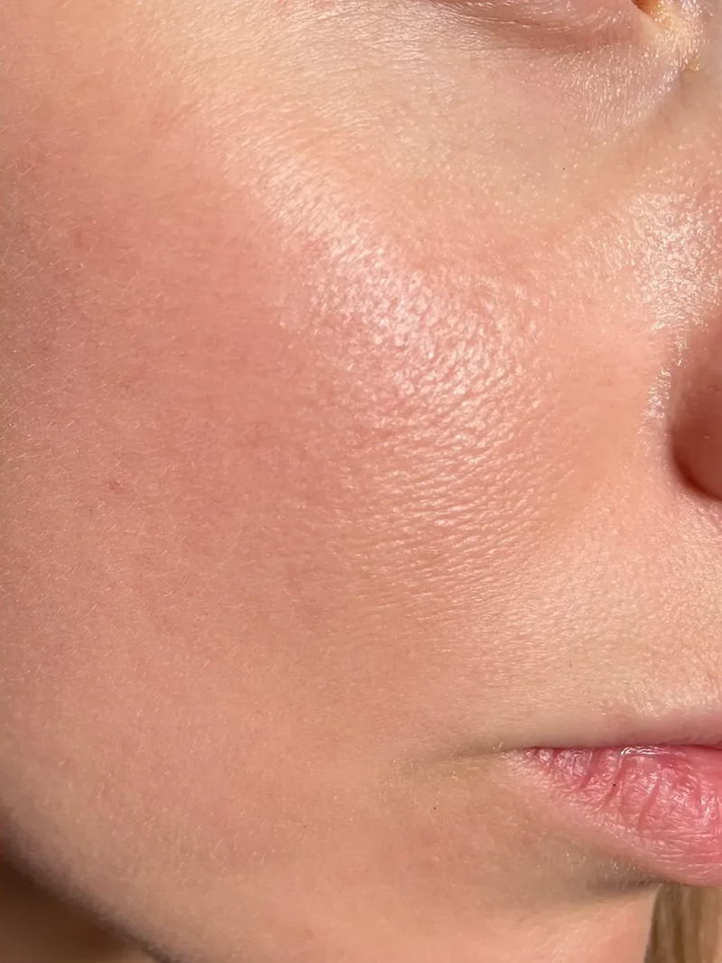 Monat 2