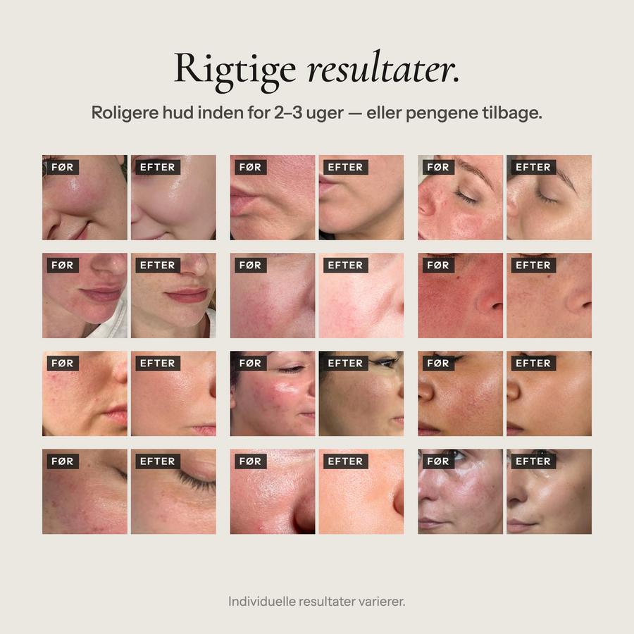 Barrier Repair Serum