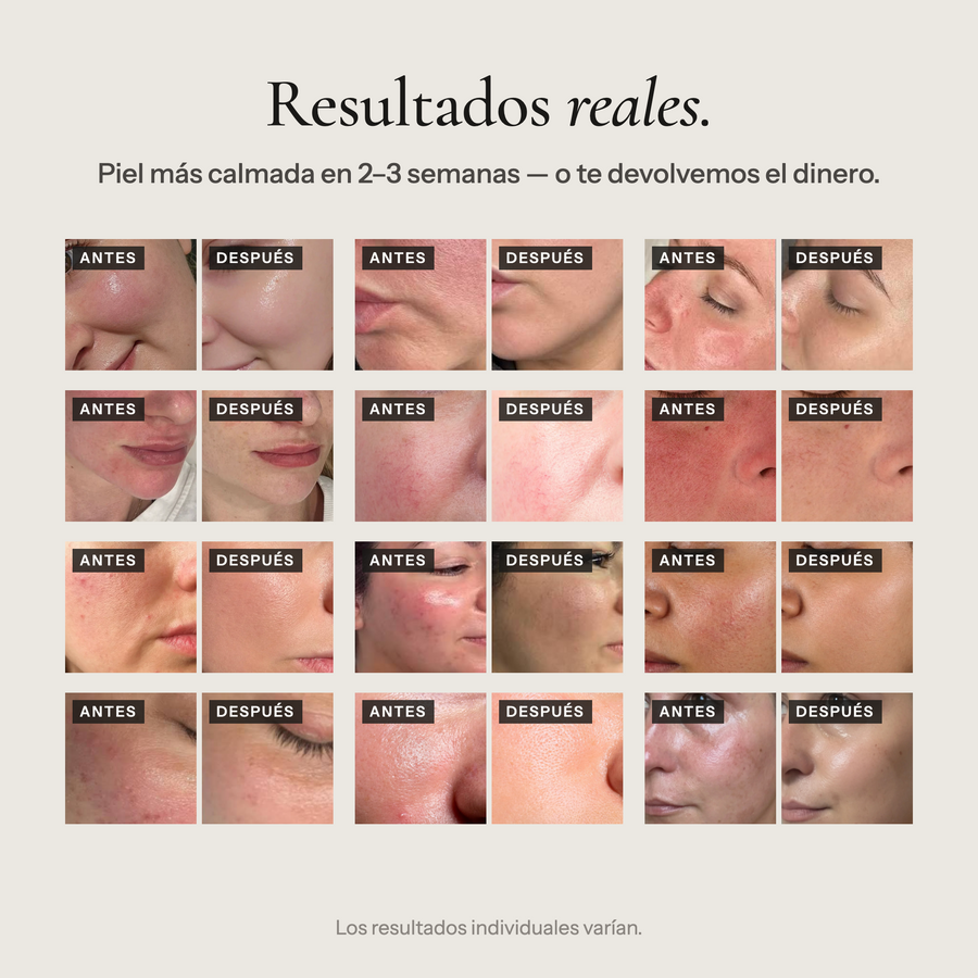 Barrier Repair Serum